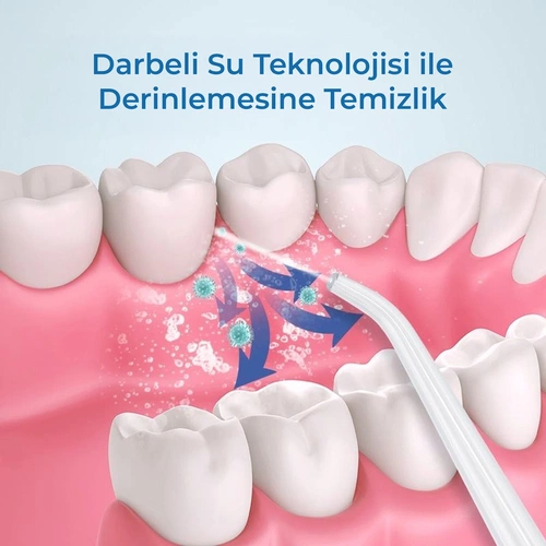 KATJMER KJ/AD-001 6886 AquaDent Ağız Duşu - Görsel 3
